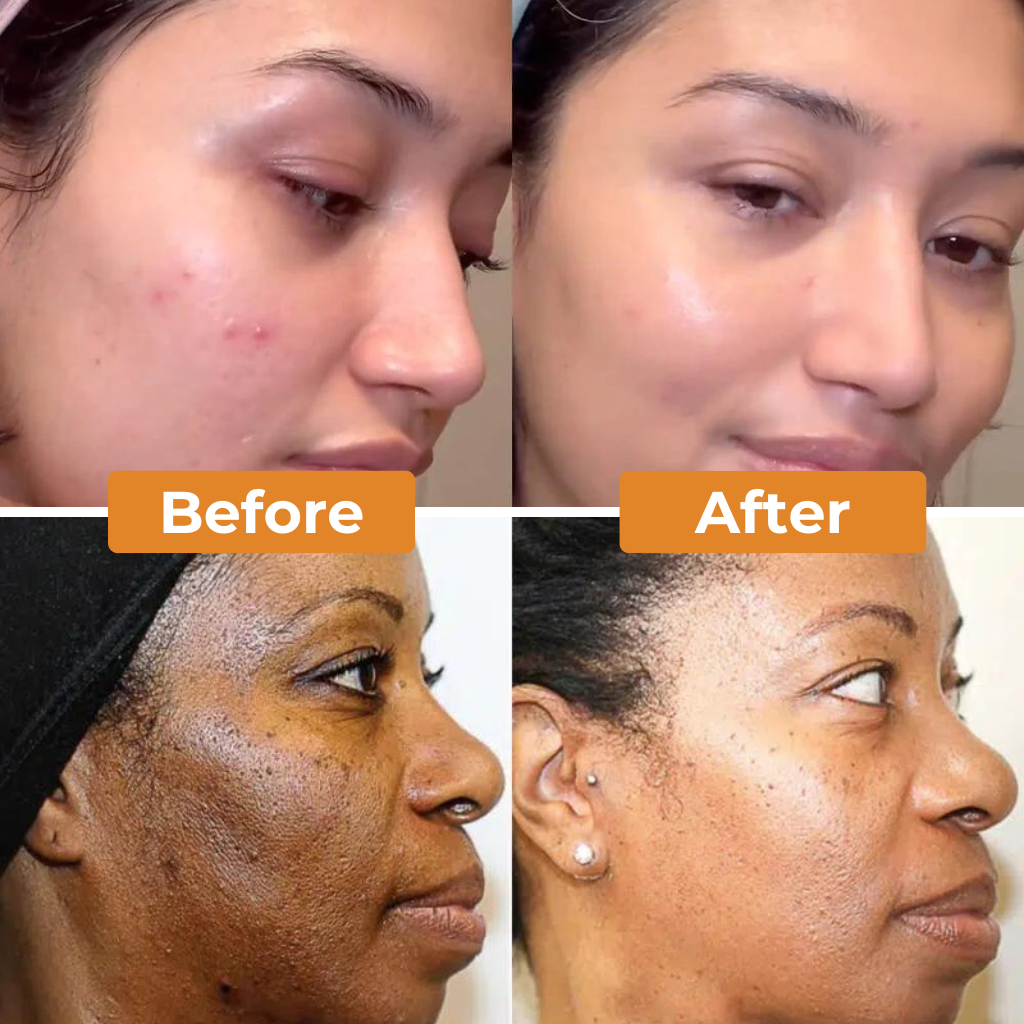 Golden Glow Tumeric Soap Bar